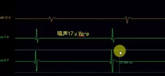 QQ截图20190108152118.png QQ截图20190108152118.png